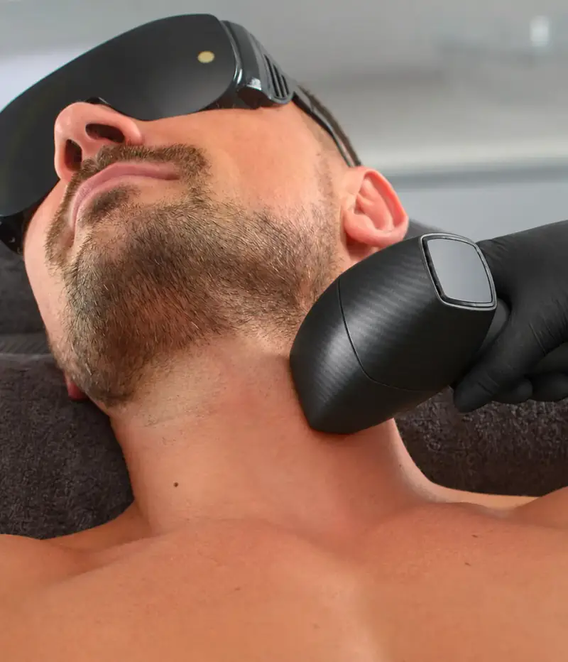 Épilation laser de la barbe et du cou d'un homme au centre Dermage Clinic à La Rochelle
