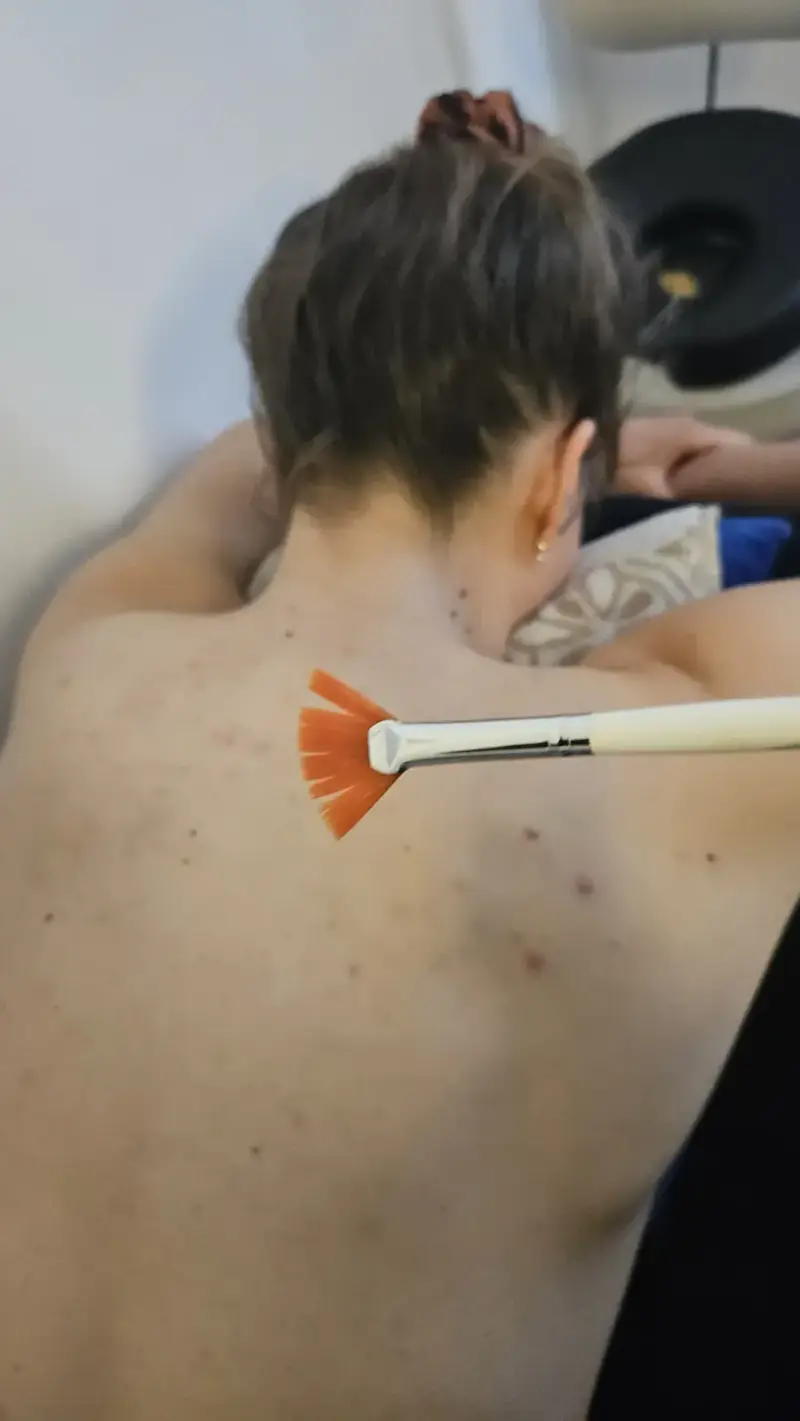 Application d'un peeling doux au pinceau sur le dos d'une cliente, au centre Dermage Clinic à La Rochelle